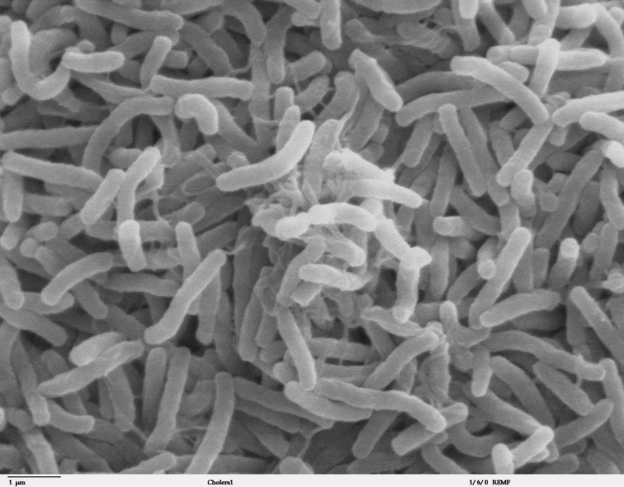 http://medthai.net/wp-content/uploads/2020/11/Cholera_bacteria_SEM.jpg