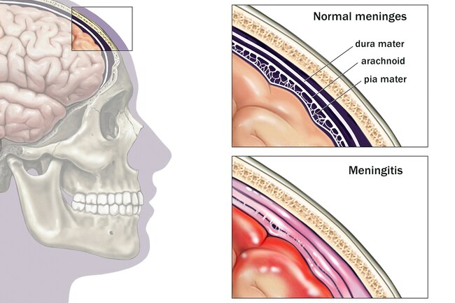 http://medthai.net/wp-content/uploads/2020/12/1800ss_medicalimages_rm_brain_meninges_illustration.jpg
