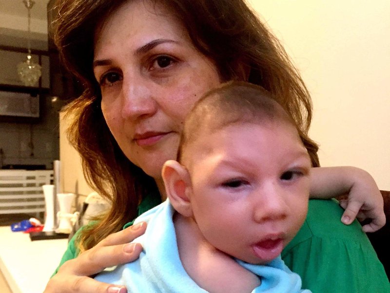Marilla Lima คุณแม่ชาวบราซิลป่วยเป็นโรคไวรัสซิกาขณะตั้งครรภ์  อาเธอร์ลูกชายวัย 2.5 เดือนของเธอมีอาการ microcephaly ซึ่งเป็นความผิดปกติ แต่กำเนิดโดยมีศีรษะเล็กและสมองถูกทำลายอย่างรุนแรง 